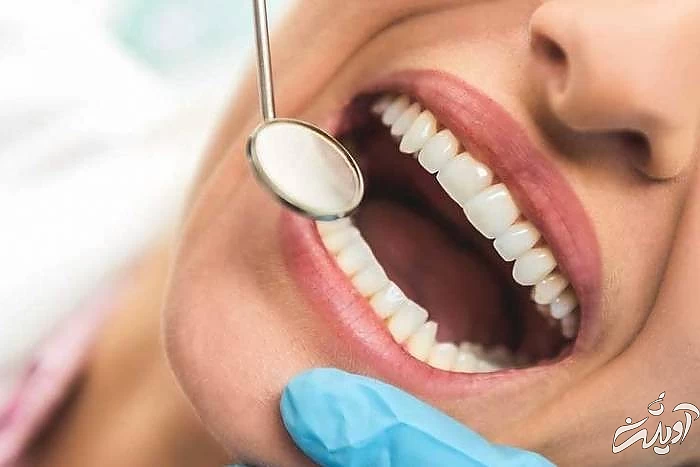 بازیابی مینای دنادن